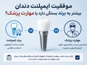موفقیت ایمپلنت دندان بیش‌تر به برند بستگی دارد یا مهارت پزشکی؟