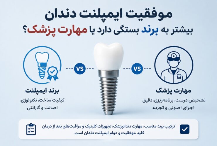 موفقیت ایمپلنت دندان بیش‌تر به برند بستگی دارد یا مهارت پزشکی؟