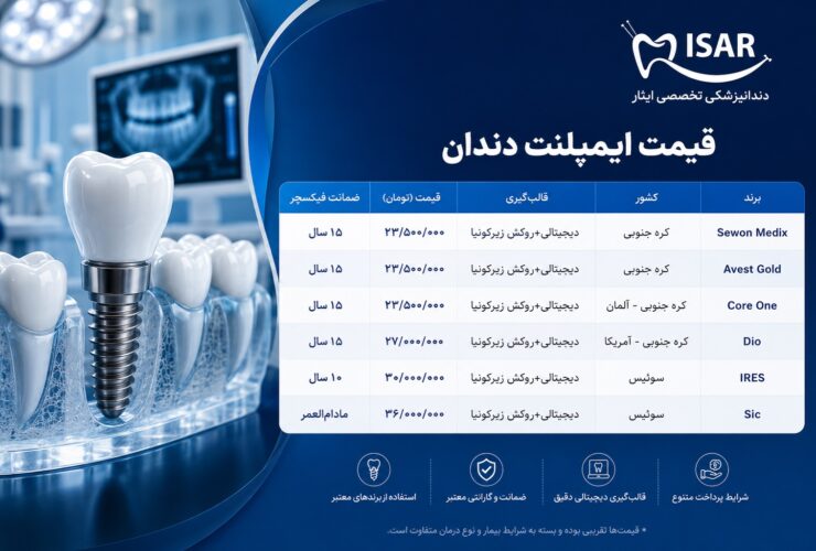 قیمت ایمپلنت